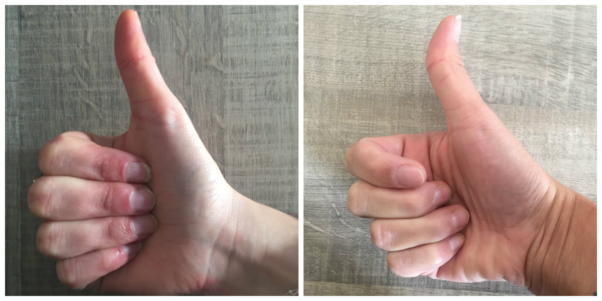 Is Your Thumb Straight Or Crooked This Is What It Can Tell You 