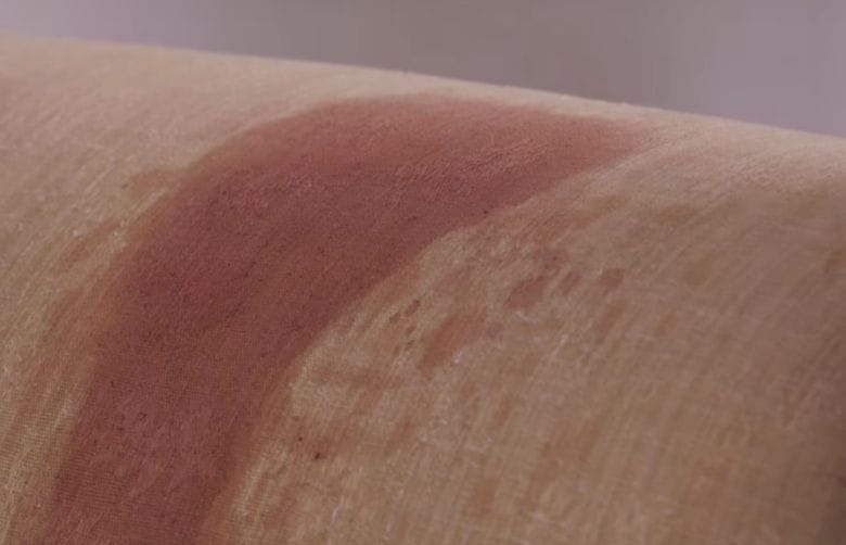 Spilled something on your sofa? With this simple solution it'll look as